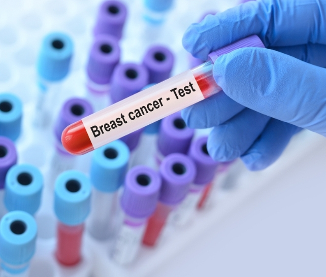 BRCA1 & BRCA2